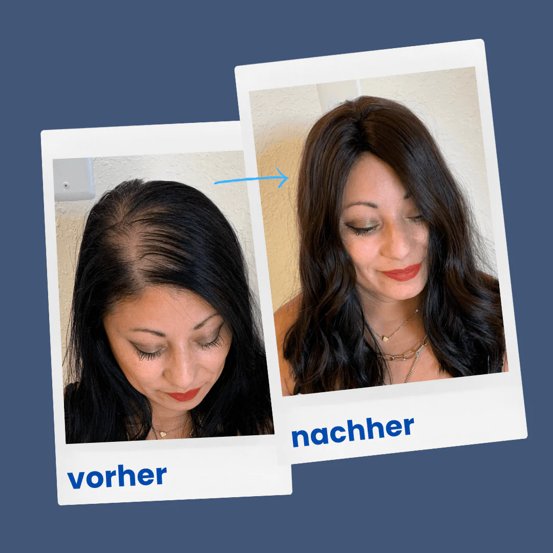 ShinyHair Haarwuchsbooster - Image 3