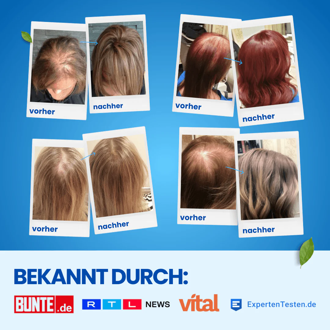 ShinyHair - Image 5