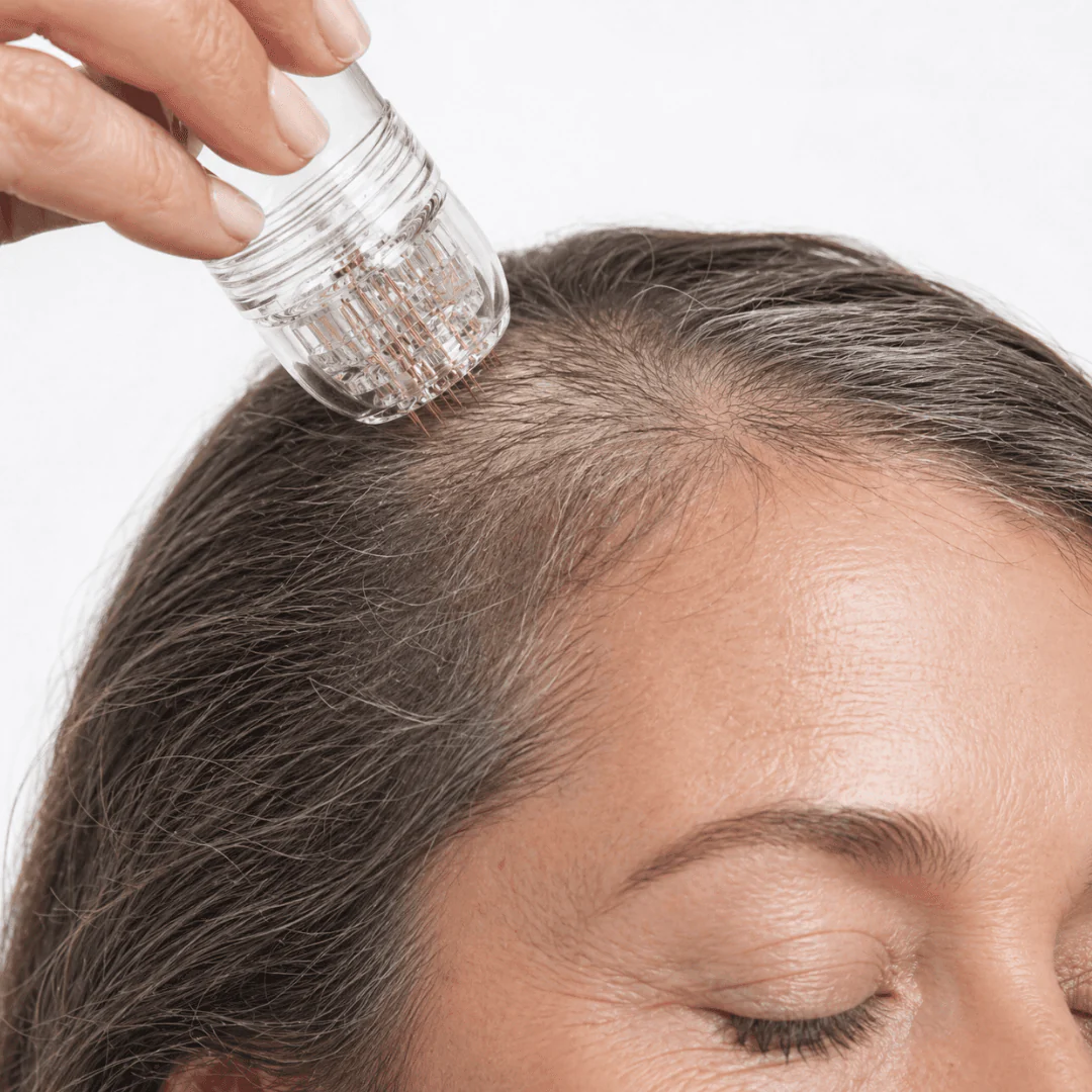 Dermastamp für die Kopfhaut - Image 8