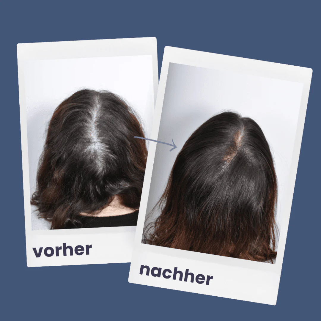 ShinyHair | Growth Kit - Image 6