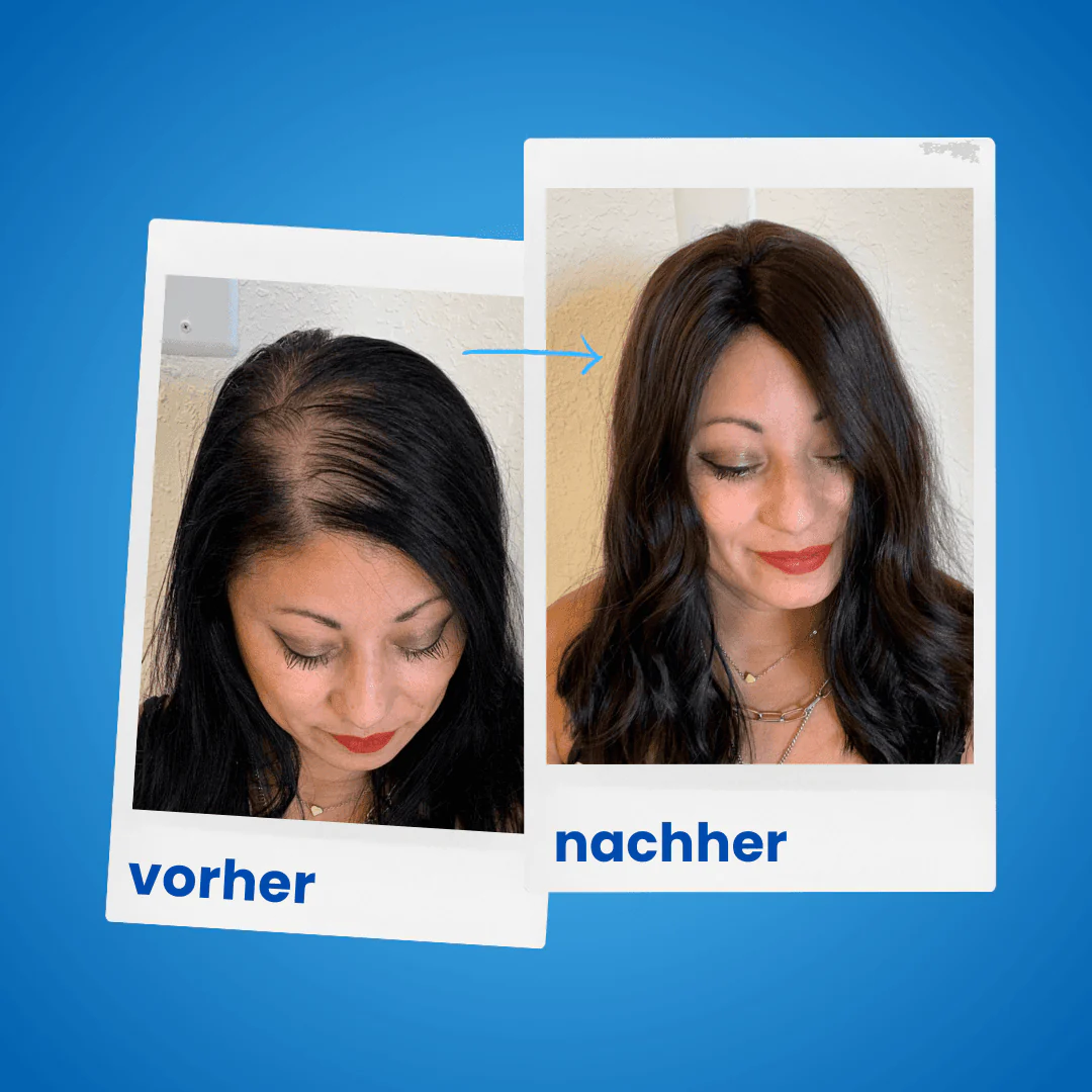 ShinyHair Haarwuchsbooster Sale - Image 4